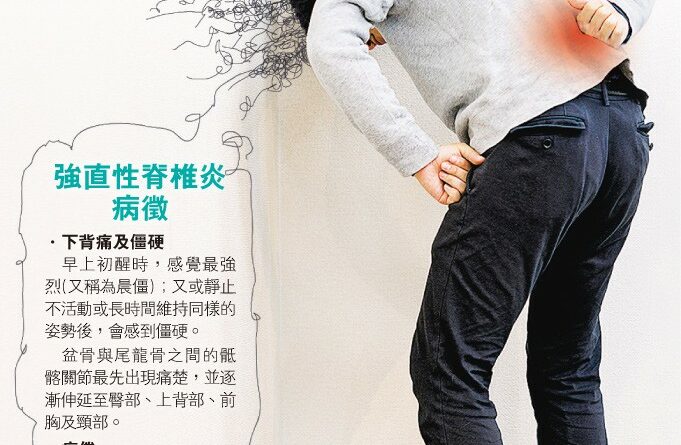 【了解風濕病】背痛難屈 變出抑鬱 強直性脊椎炎 愈遲醫愈傷「心」