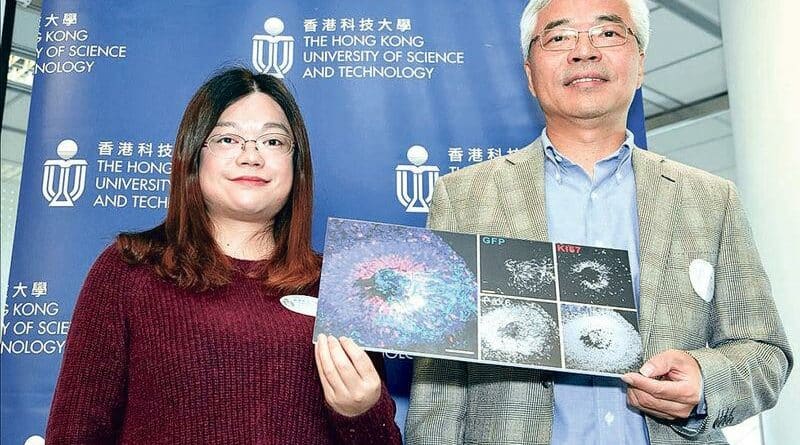 科大揭引發精神病基因變異機理