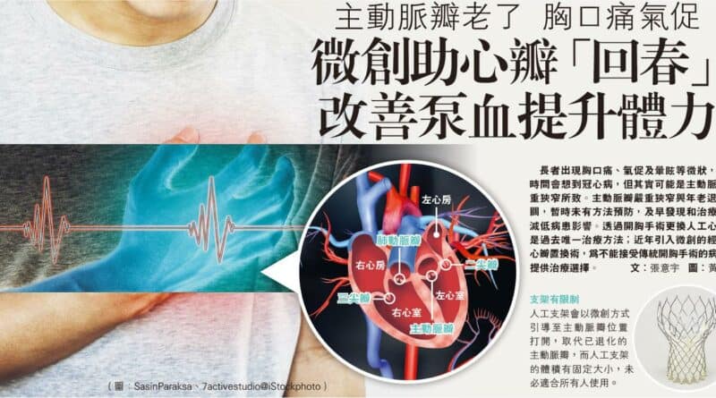 【有片】主動脈瓣老了 胸口痛氣促 微創助心瓣「回春」 改善泵血提升體力