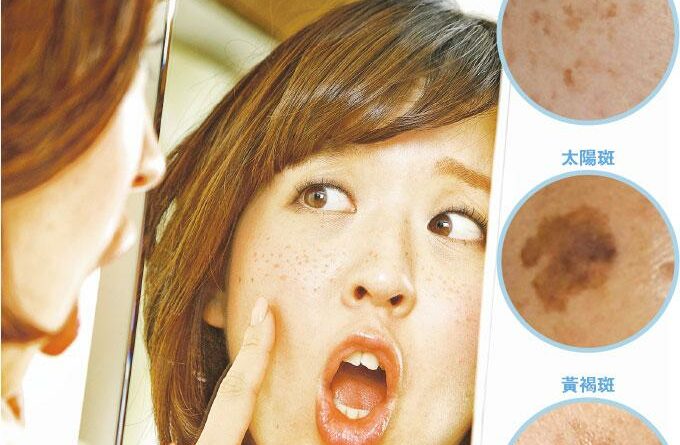 【女性健康】嬲到出斑 敷面疏肝有救