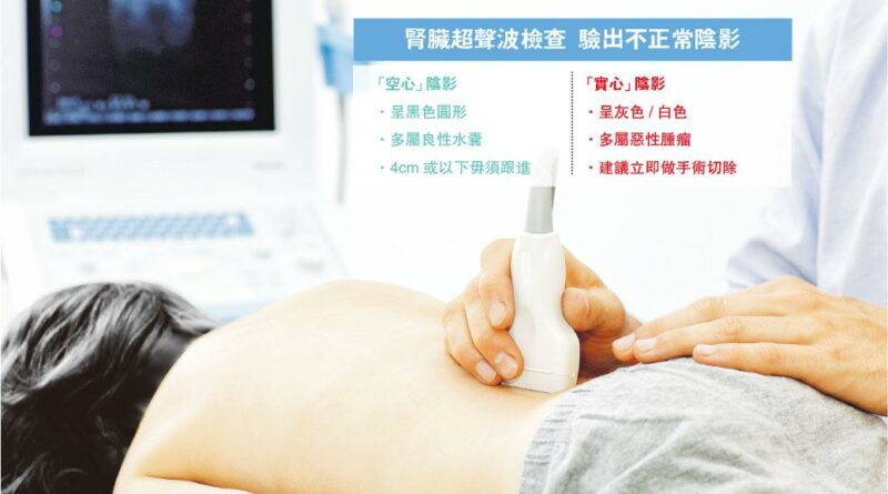 【有片】超聲波見腎囊腫 空心虛驚 實心多癌變