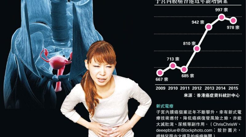 【女性健康】減副作用 復發率<3％ 手術＋近接電療 夾擊子宮內膜癌