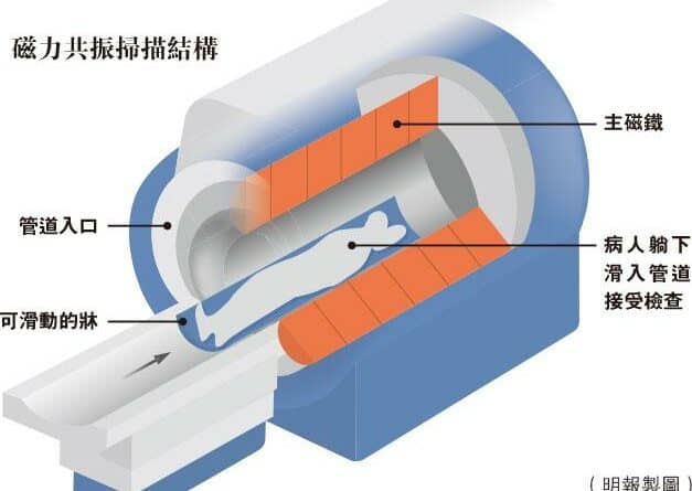知多啲：磁力共振技術大躍進 需時噪音大減