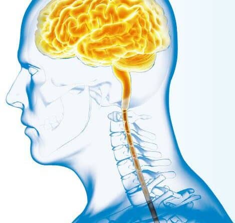 立體定向放療 瞄準腦轉移癌魔