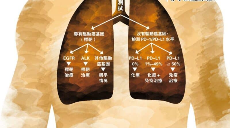 肺癌; 標靶藥; 莫樹錦; IPASS;