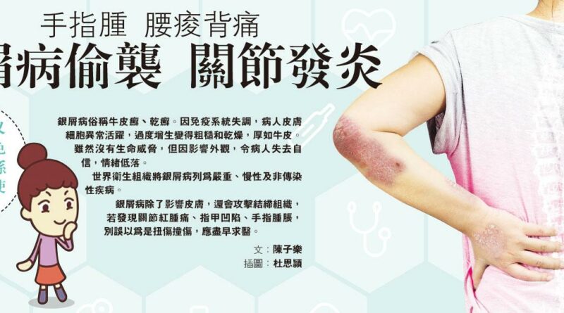 銀屑病, 牛皮癬, 乾癬, 關節炎, 關節痛,