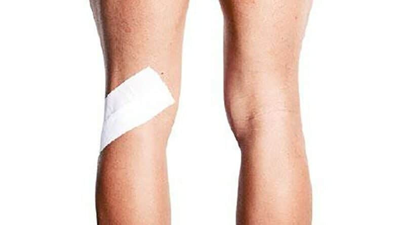 【運動消閒】好Zone動：膠布紓緩「慢半拍」膝痛