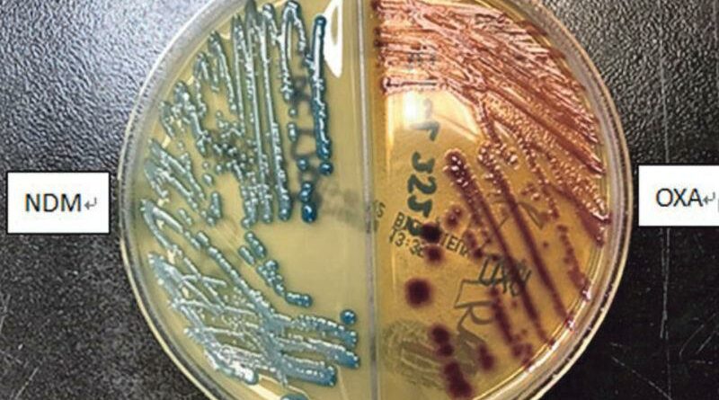 抗藥惡菌CPE個案倍升 專家：每年數宗無藥可治 部分死亡