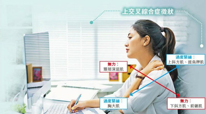 白領坐姿差 上交叉現身 頸梗膊痛 嚴重致肌肉萎縮