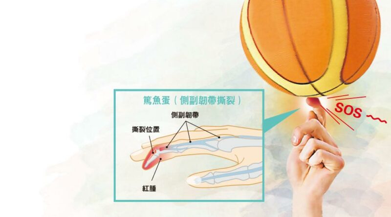 【有片】輕視篤魚蛋 小心一世無力揸筷子