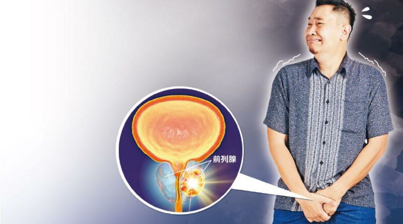 前列腺癌最新療法 一日一粒藥 保住「蛋蛋」