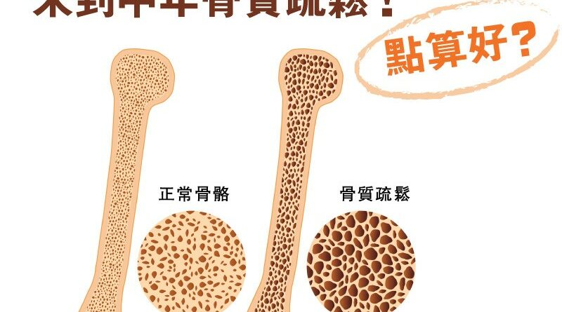 世界骨質疏鬆日丨預防骨折、骨頭脆 補鈣3大謬誤 附高鈣營養餐單 訓練養生要有法