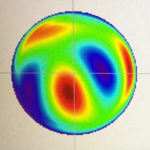 Keratoconus_20210216_02