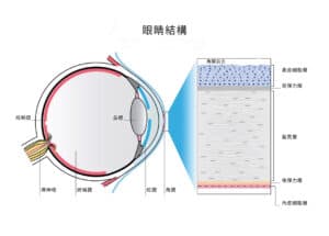 Penetrating Keratoplasty_20210430_04