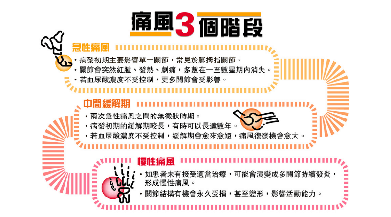 痛風成因多 尿酸作怪影響關節 戒吃高嘌呤食物有用嗎？預防急性痛風注意3件事