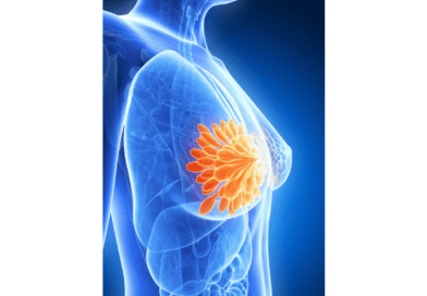 乳癌如子宮頸癌早期病徵不明顯  「全身檢查」足夠揪出乳癌嗎？(醫路同行)