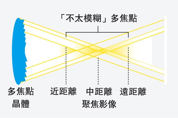 白內障手術植入人工晶體後 近視老花有變 再配眼鏡要考慮？