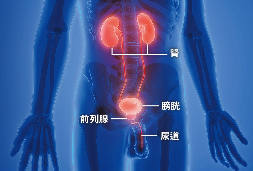 前列腺癌警號：血尿、尿頻、勃起功能障礙 格里森評分最高10分 癌細胞擴散生長快