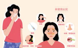 鼻竇炎6症狀可同時出現 急性慢性治療有分別  洗鼻改善鼻塞