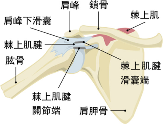 【痛症】 肩夾擊綜合徵？非肩痛元兇 運動重塑肌腱促進康復