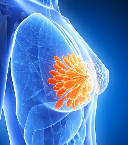 乳癌關注月   提高警覺預防乳癌 早識別、早介入　提升治癒率