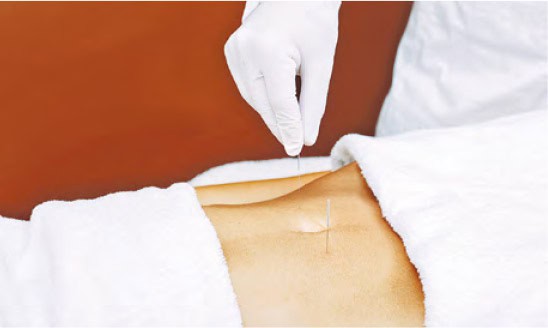 腸易激綜合徵：緊張腹痛肚瀉、大便質地頻次有變   肝脾失調宜重整腸胃功能