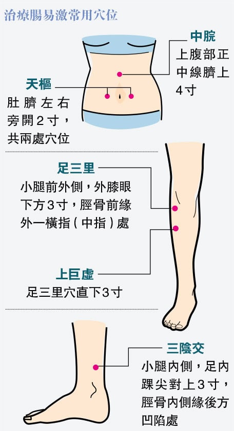 腸易激綜合徵：緊張腹痛肚瀉、大便質地頻次有變   肝脾失調宜重整腸胃功能