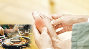 長期將尿酸水平控制在6mg/dL以下，並避免高嘌呤食物、酒精及濃湯底，多喝清水、保持足部溫暖，並在醫生指導下持續服用降尿酸藥物。