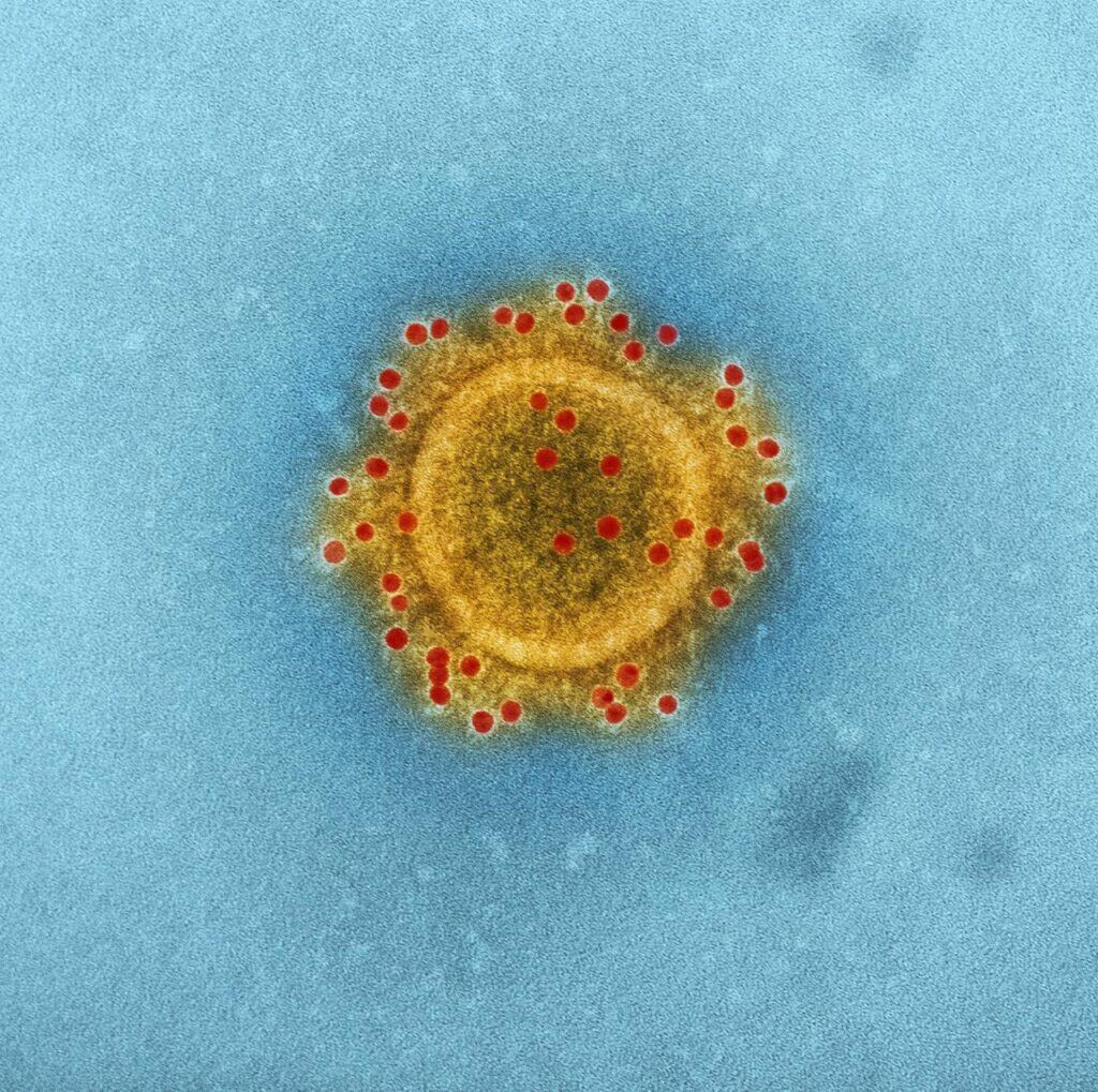 漢坦病毒(Hantavirus)初起病徵似流感 後或致心臟和肺衰竭 香港較少見 漢坦病毒(Hantavirus)初起病徵似流感 後或致心臟和肺衰竭 香港較少見