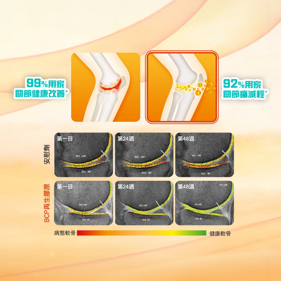 軟骨流失真的不可逆?新一代德國Mobility動必骼重塑靈活未來! 軟骨流失真的不可逆?新一代德國Mobility動必骼重塑靈活未來!